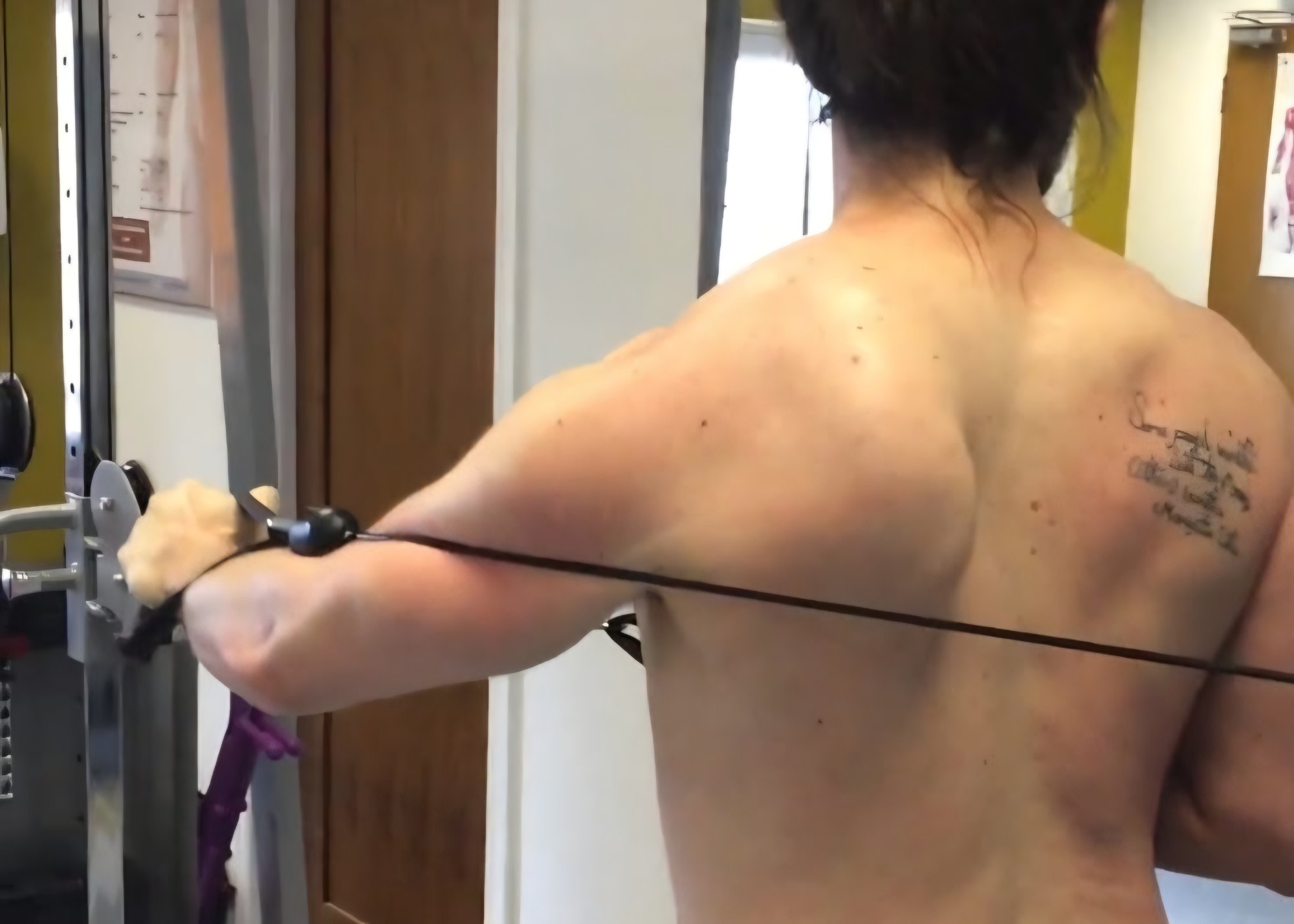 Scapular Wing 